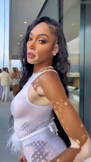 Winnie Harlow / winnieharlow фото голая #0145