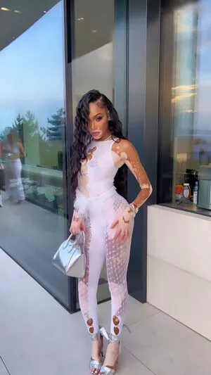 Winnie Harlow / winnieharlow фото голая #0147