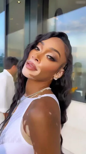 Winnie Harlow / winnieharlow фото голая #0148