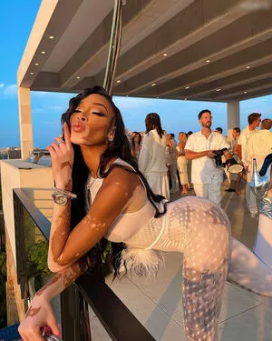 Winnie Harlow / winnieharlow фото голая #0157