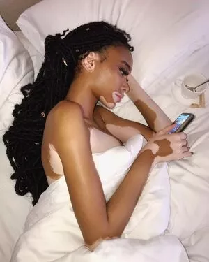 Winnie Harlow / winnieharlow фото голая #0159