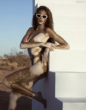 Winnie Harlow / winnieharlow фото голая #0161