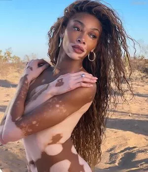 Winnie Harlow / winnieharlow фото голая #0163