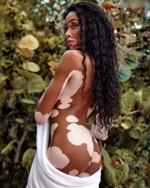 Winnie Harlow / winnieharlow фото голая #0169
