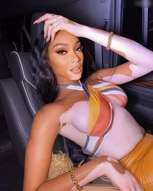 Winnie Harlow / winnieharlow фото голая #0171