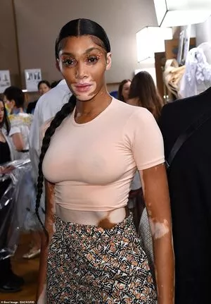 Winnie Harlow / winnieharlow фото голая #0173
