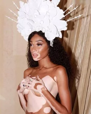 Winnie Harlow / winnieharlow фото голая #0176