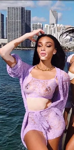 Winnie Harlow / winnieharlow фото голая #0199