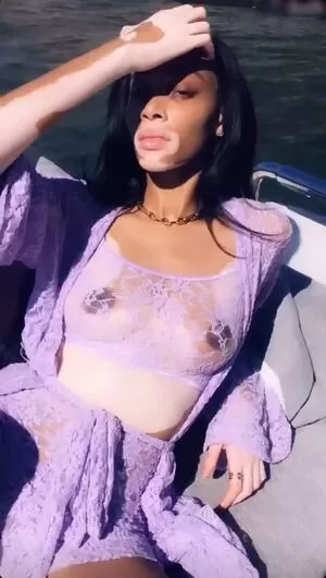 Winnie Harlow / winnieharlow фото голая #0204