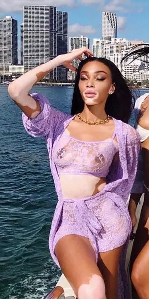 Winnie Harlow / winnieharlow фото голая #0205