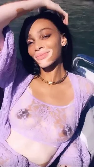 Winnie Harlow / winnieharlow фото голая #0206