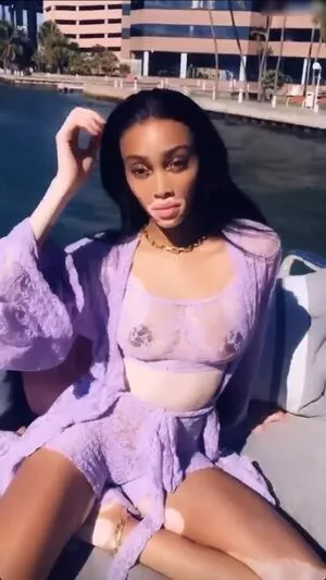 Winnie Harlow / winnieharlow фото голая #0208