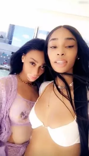 Winnie Harlow / winnieharlow фото голая #0209