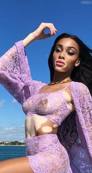 Winnie Harlow / winnieharlow фото голая #0210