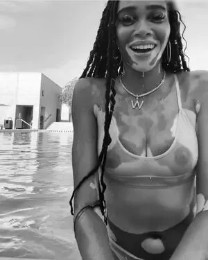 Winnie Harlow / winnieharlow фото голая #0212