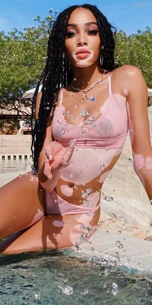 Winnie Harlow / winnieharlow фото голая #0214