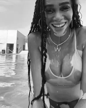 Winnie Harlow / winnieharlow фото голая #0215
