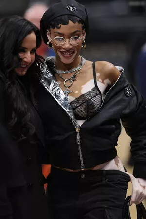 Winnie Harlow / winnieharlow фото голая #0226