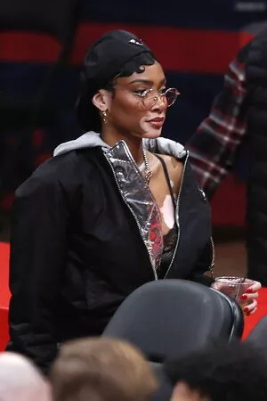 Winnie Harlow / winnieharlow фото голая #0227
