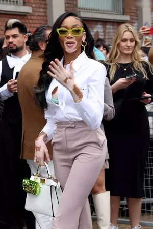 Winnie Harlow / winnieharlow фото голая #0255