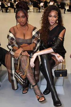 Winnie Harlow / winnieharlow фото голая #0260