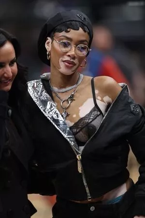 Winnie Harlow / winnieharlow фото голая #0467