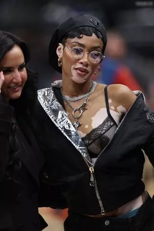 Winnie Harlow / winnieharlow фото голая #0471
