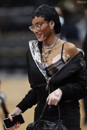 Winnie Harlow / winnieharlow фото голая #0472