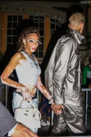 Winnie Harlow / winnieharlow фото голая #0476