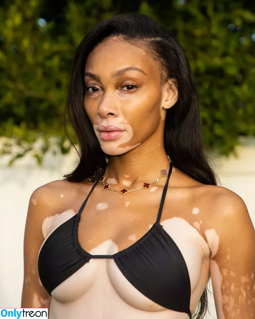 Winnie Harlow nude photo #0039 (winnieharlow)