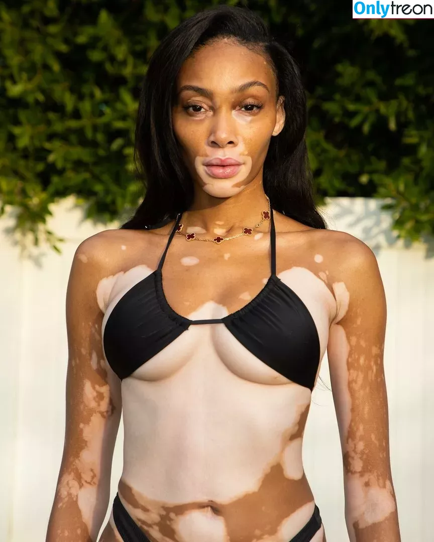 Winnie Harlow nude photo #0041 (winnieharlow)