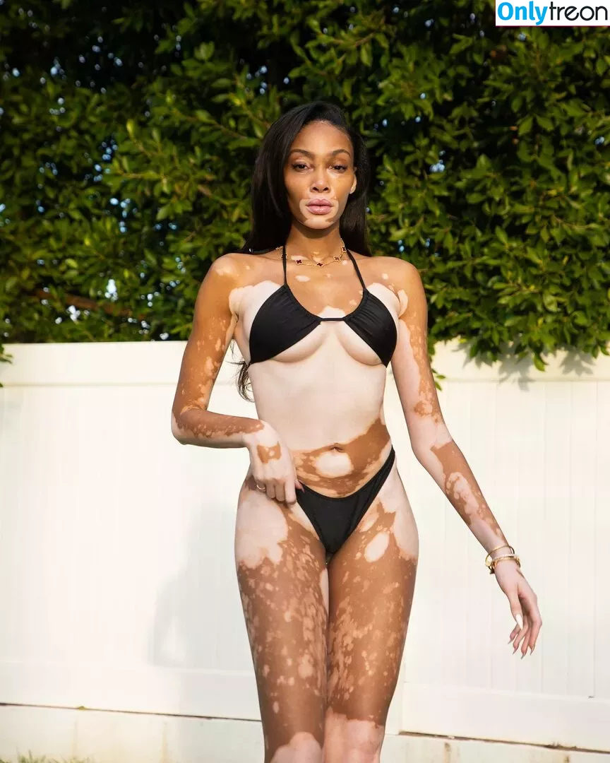 Winnie Harlow nude photo #0042 (winnieharlow)