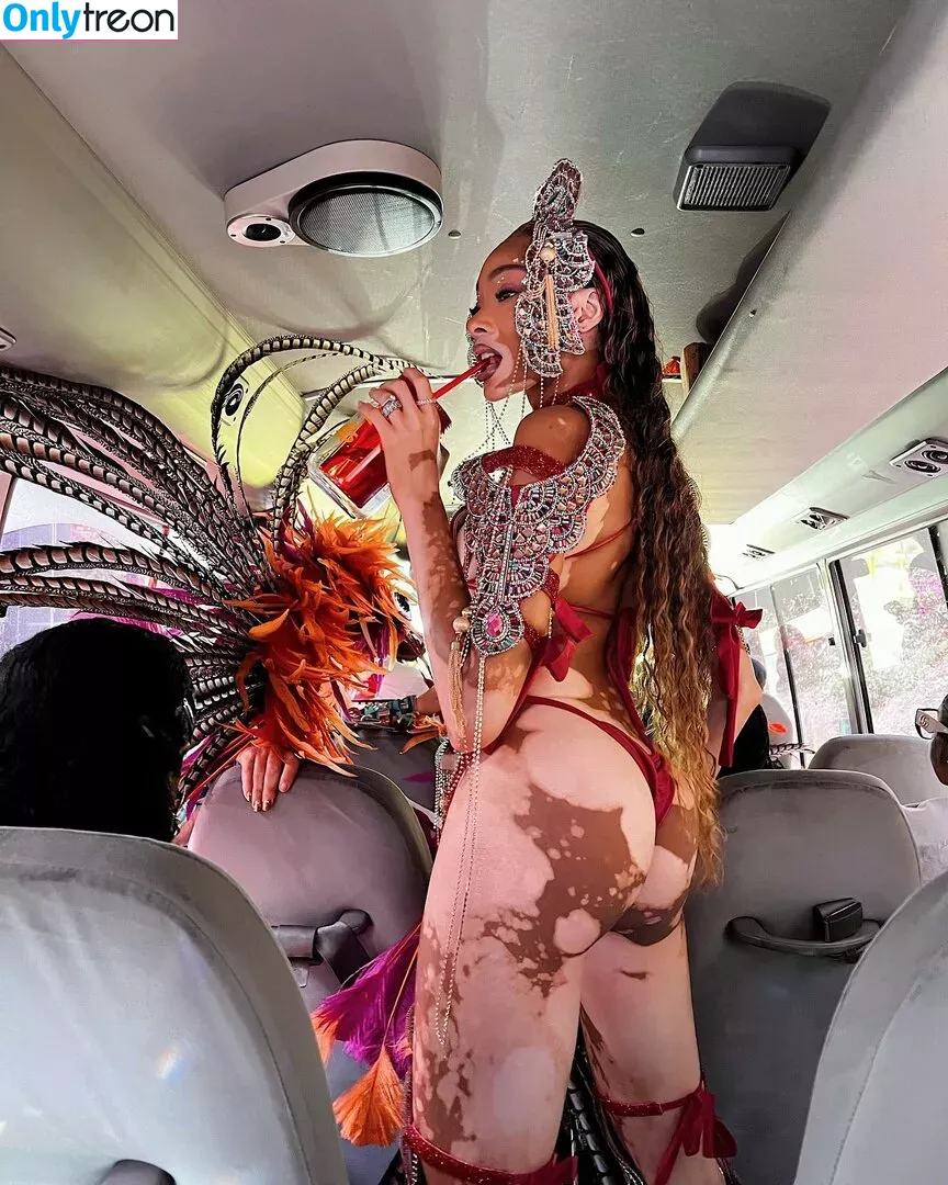 Winnie Harlow nude photo #0044 (winnieharlow)