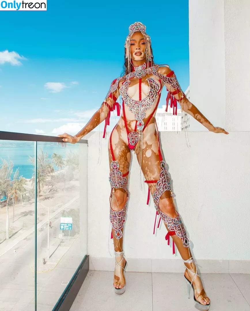 Winnie Harlow nude photo #0052 (winnieharlow)