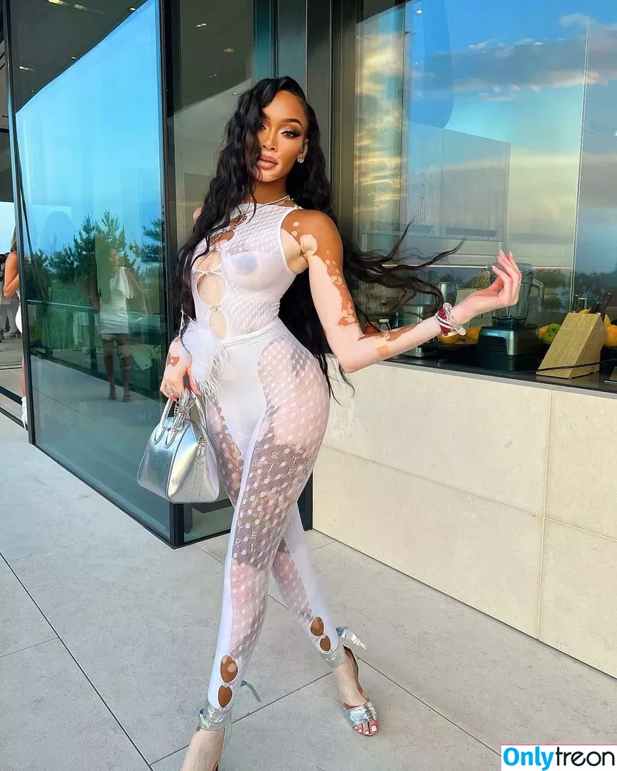Winnie Harlow nude photo #0058 (winnieharlow)