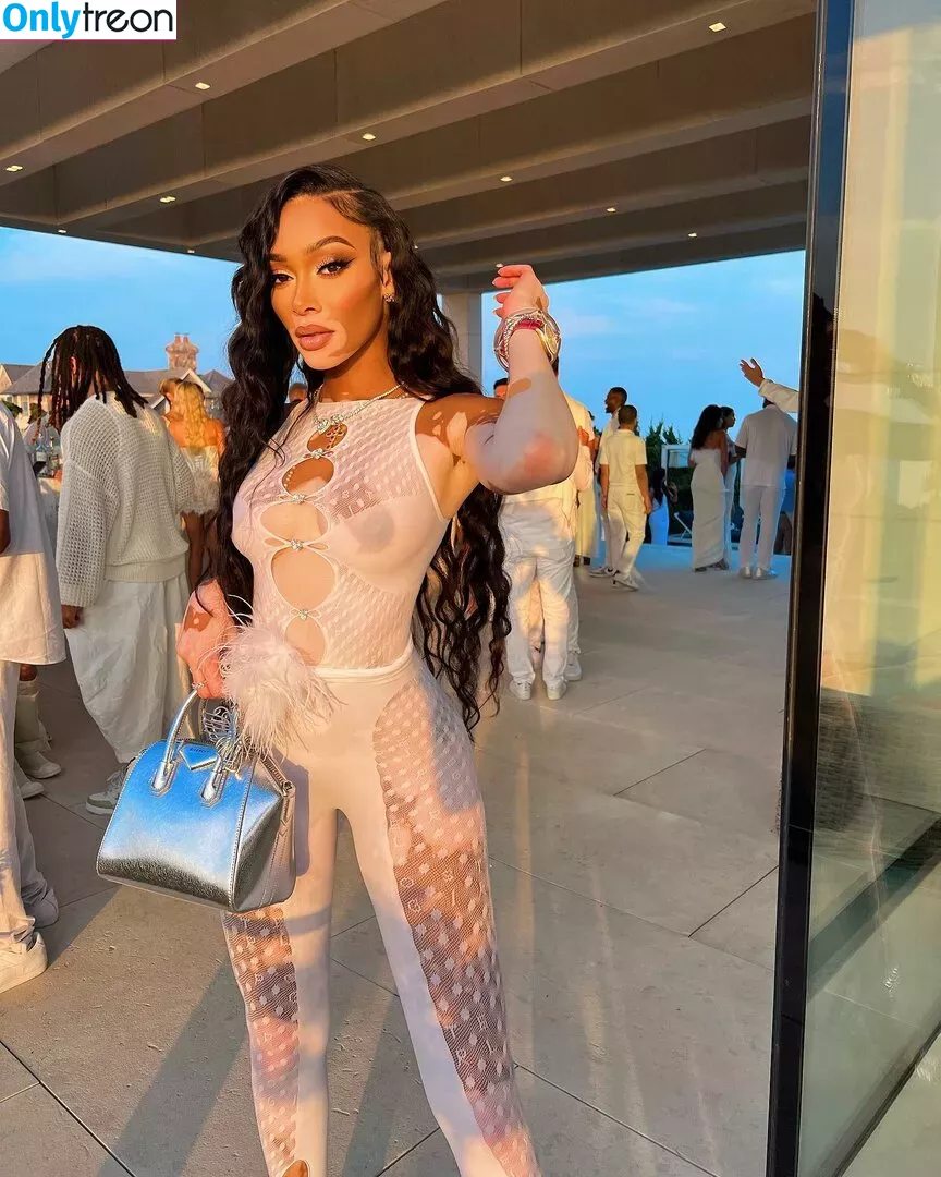 Winnie Harlow nude photo #0059 (winnieharlow)
