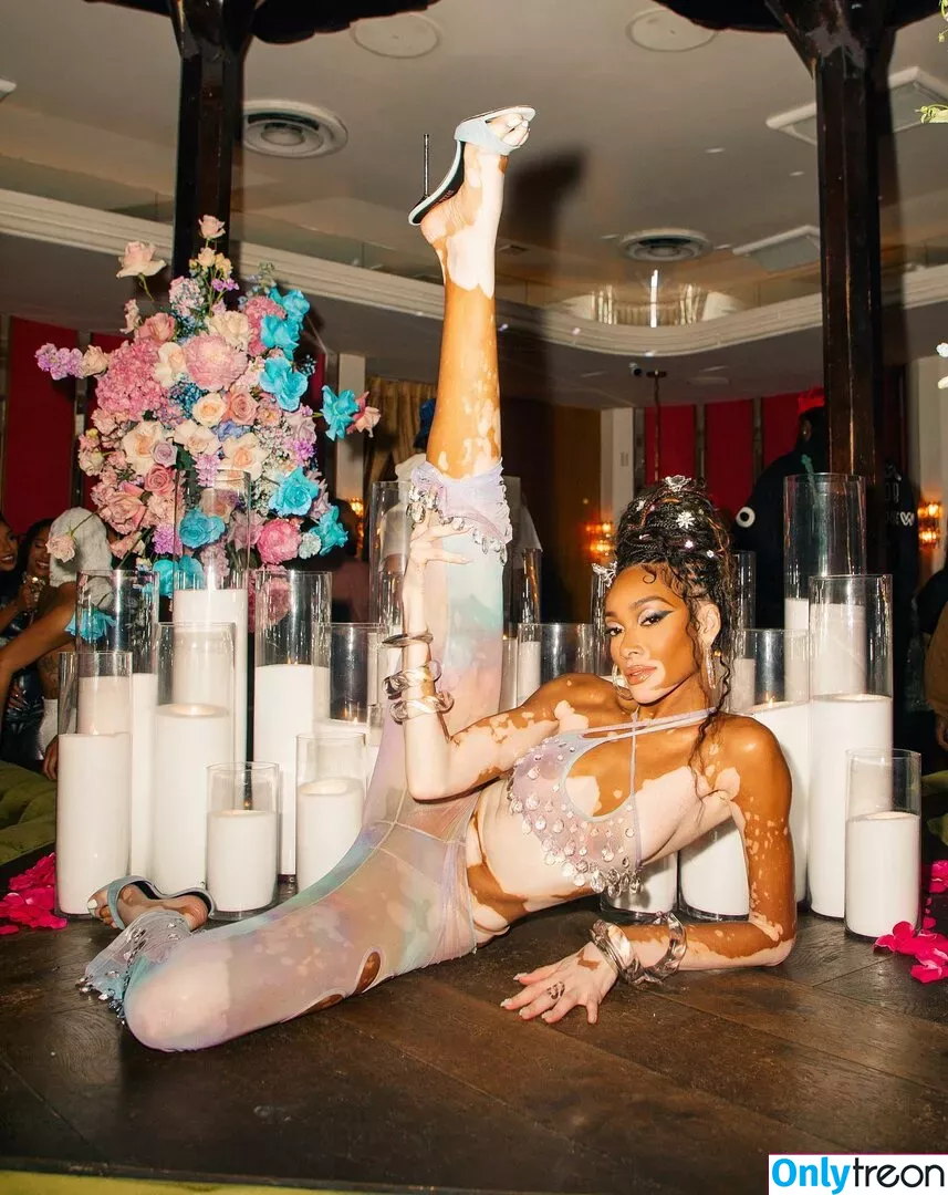 Winnie Harlow nude photo #0065 (winnieharlow)