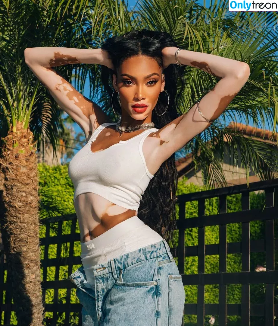 Winnie Harlow nude photo #0068 (winnieharlow)