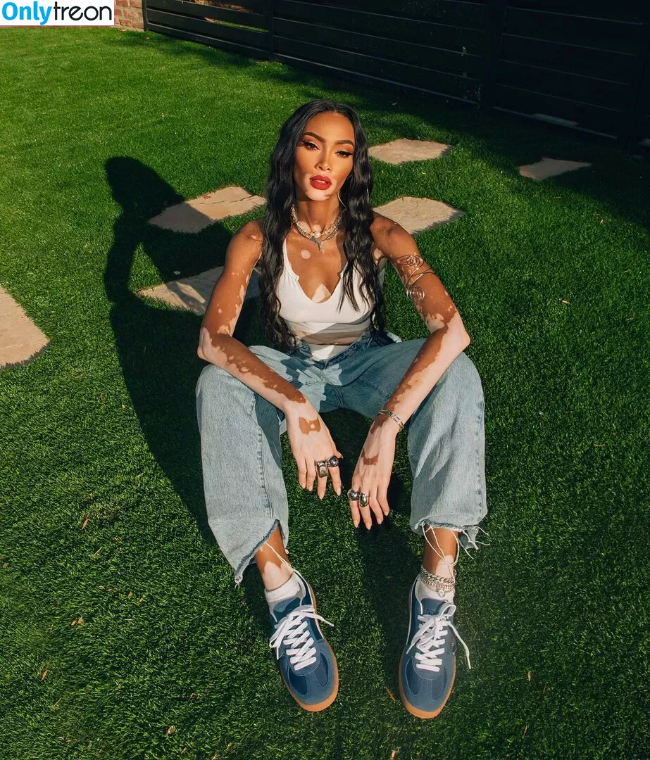 Winnie Harlow nude photo #0069 (winnieharlow)
