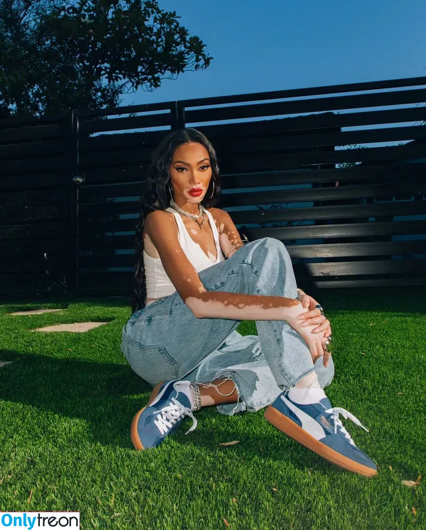 Winnie Harlow nude photo #0070 (winnieharlow)
