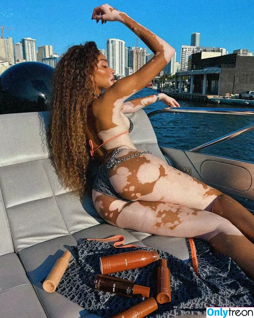 Winnie Harlow nude photo #0074 (winnieharlow)