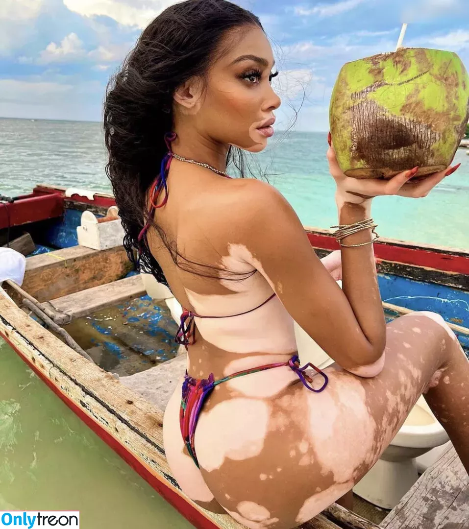 Winnie Harlow nude photo #0079 (winnieharlow)