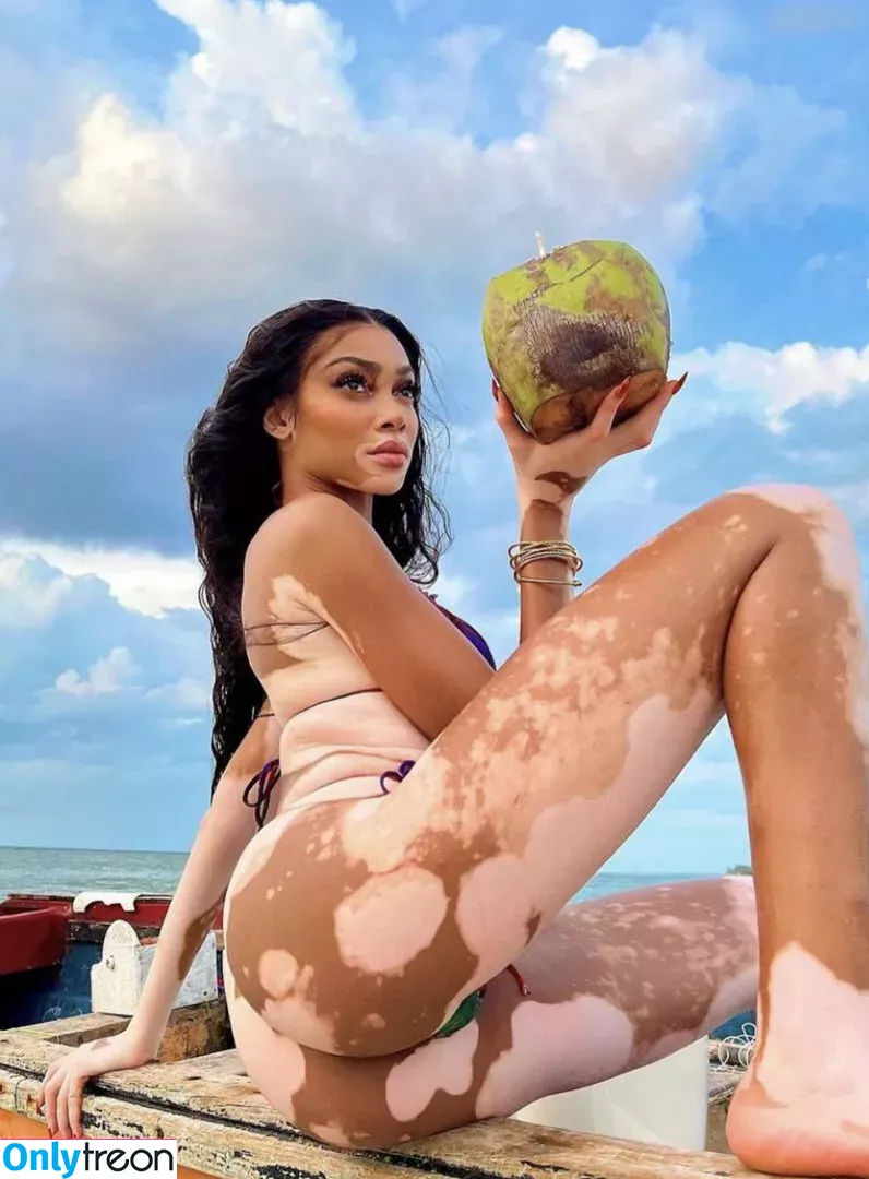 Winnie Harlow nude photo #0080 (winnieharlow)