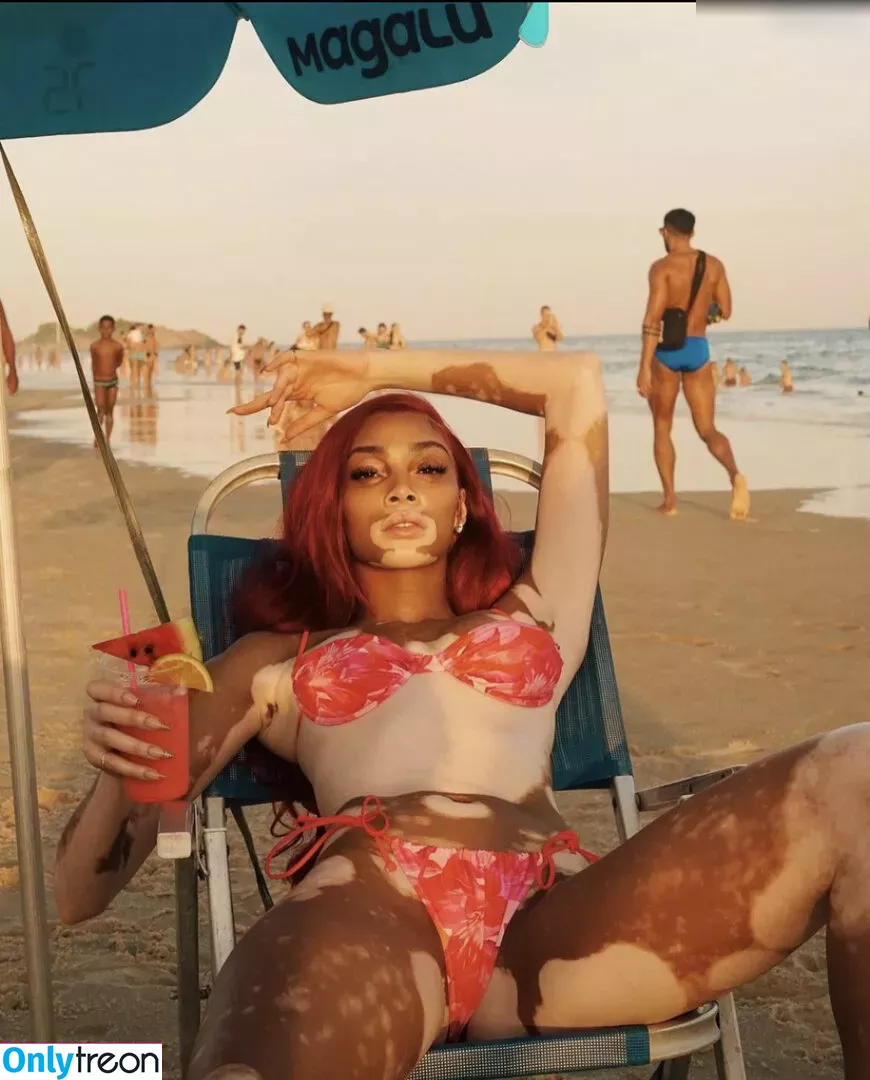 Winnie Harlow nude photo #0081 (winnieharlow)