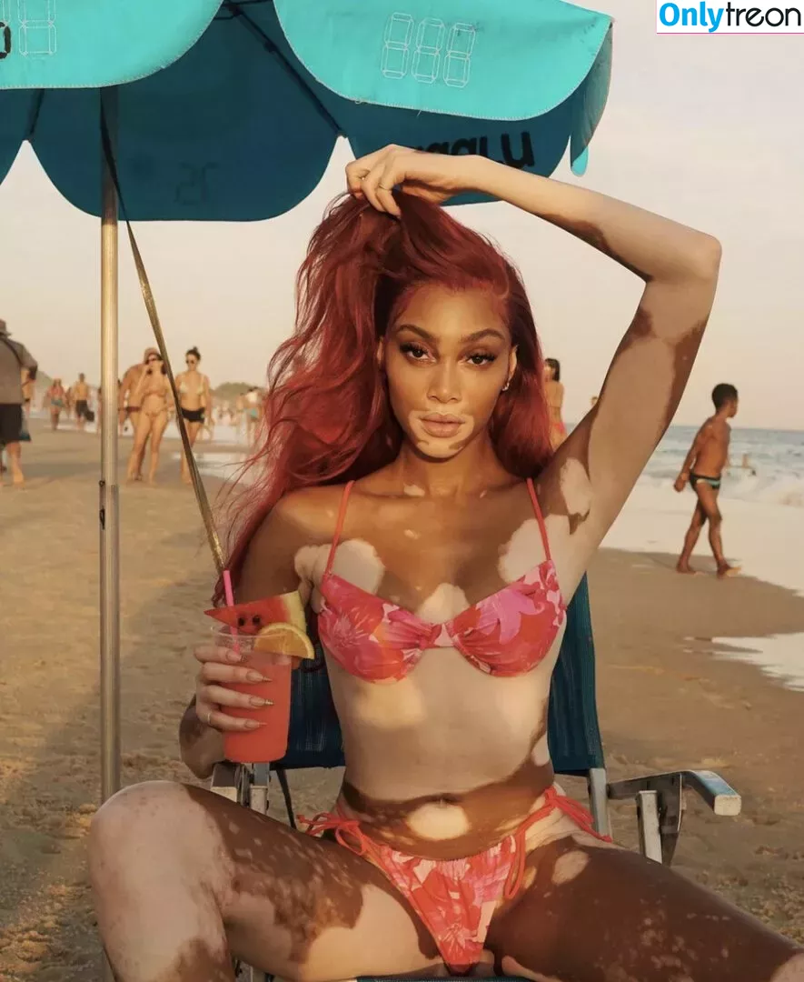 Winnie Harlow голая photo #0082 (winnieharlow)