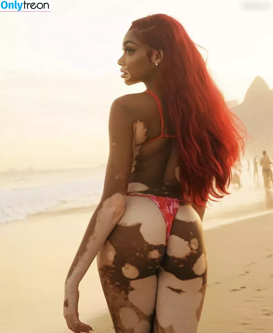 Winnie Harlow nude photo #0083 (winnieharlow)