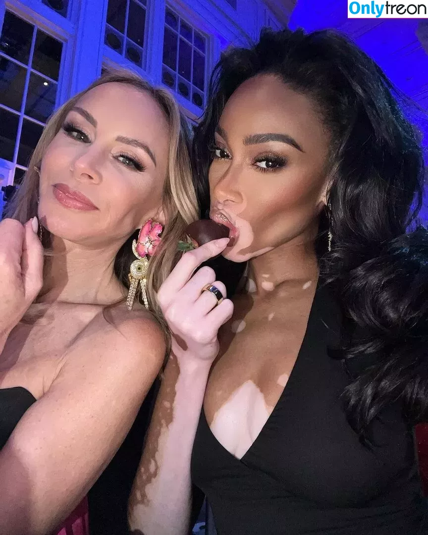 Winnie Harlow голая photo #0087 (winnieharlow)