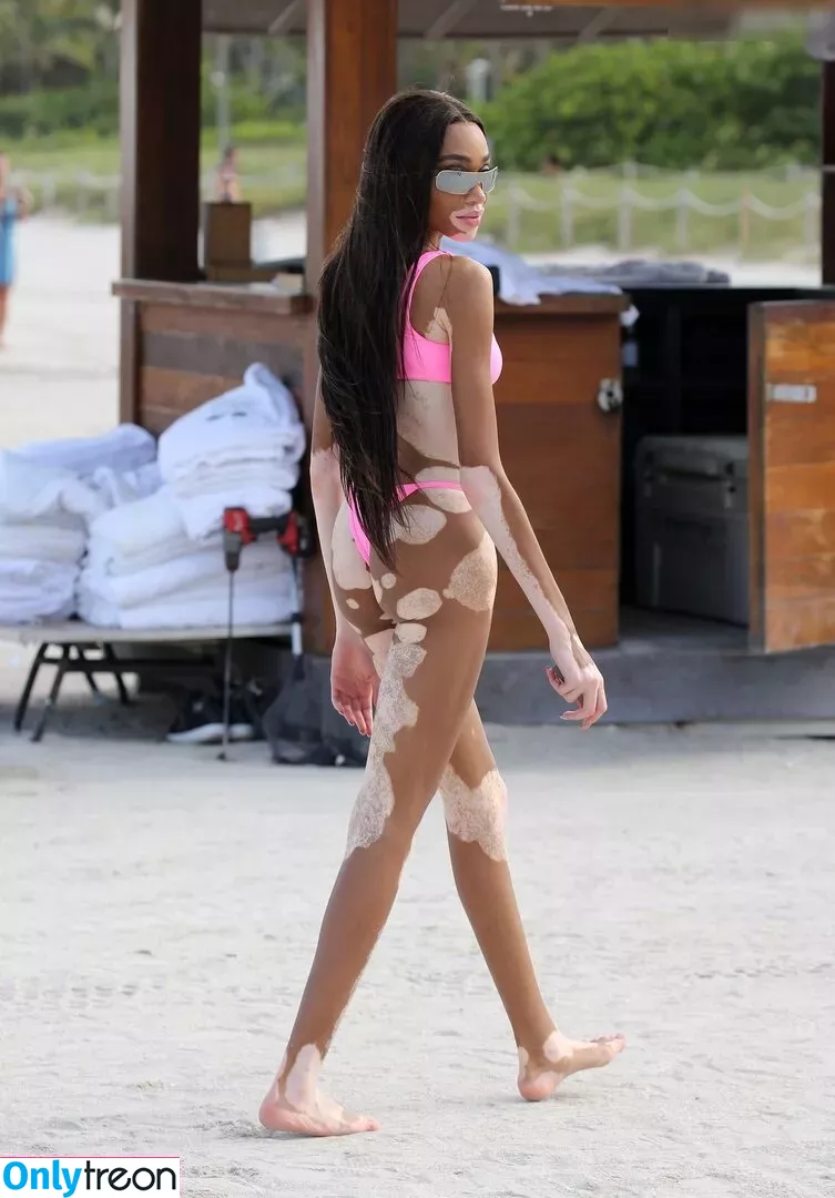 Winnie Harlow nude photo #0093 (winnieharlow)