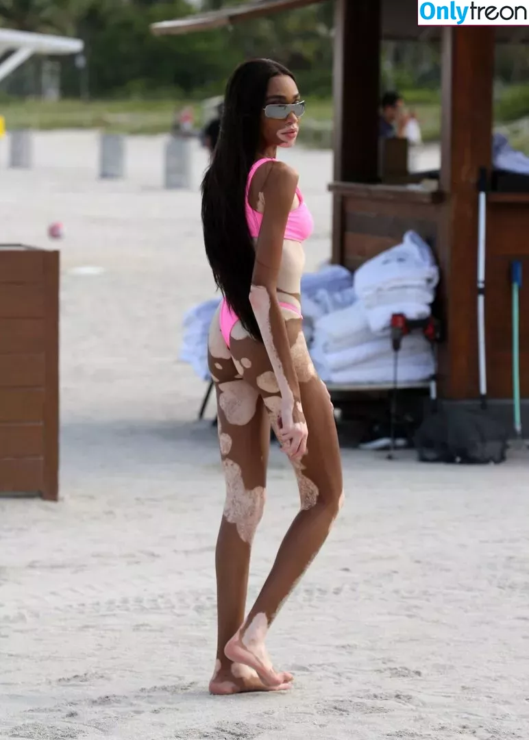 Winnie Harlow nude photo #0101 (winnieharlow)