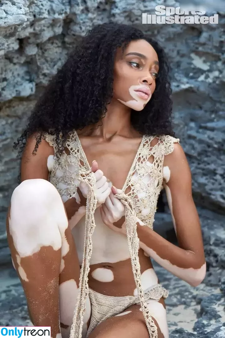 Winnie Harlow nude photo #0102 (winnieharlow)